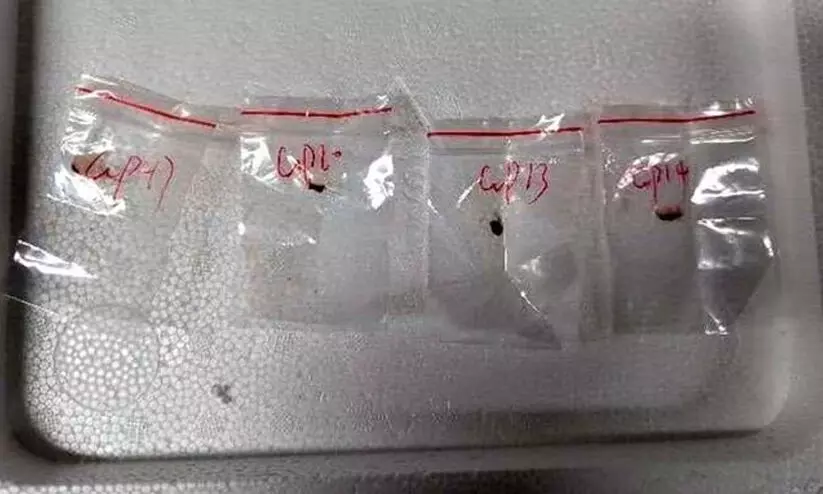 അമേരിക്കയിലേക്ക് അപകടകാരിയായ ഫംഗസുകളെ കടത്താൻ ശ്രമം; രണ്ട് ചൈനീസ് പൗരന്മാരെ അറസ്റ്റ് ചെയ്ത് എഫ്.ബി.ഐ