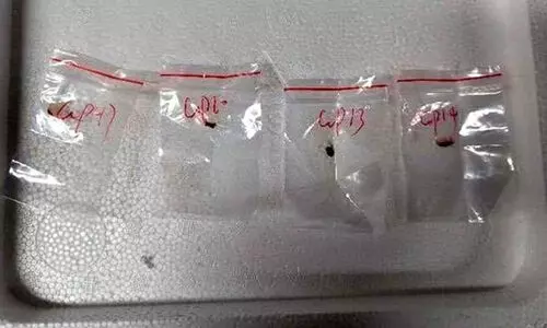 അമേരിക്കയിലേക്ക് അപകടകാരിയായ ഫംഗസുകളെ കടത്താൻ ശ്രമം; രണ്ട് ചൈനീസ് പൗരന്മാരെ അറസ്റ്റ് ചെയ്ത് എഫ്.ബി.ഐ