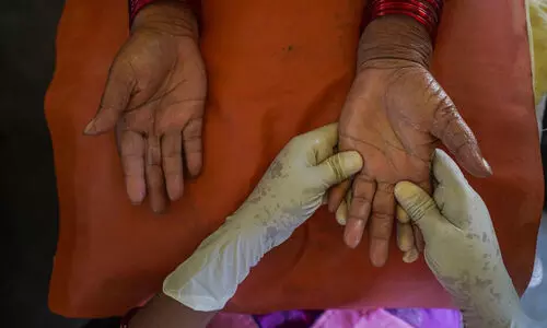 അഞ്ചുവർഷത്തിനിടെ 1.13 ലക്ഷം ക്ഷയരോഗികൾ, 1949 കുഷ്ഠരോഗികൾ