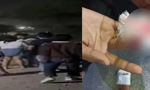 ഛത്തീസ്ഗഢിൽ പെൺകുട്ടികൾക്ക് നേരെ ആൾക്കൂട്ടാക്രമണം; വിരൽ കടിച്ച് മുറിച്ചു