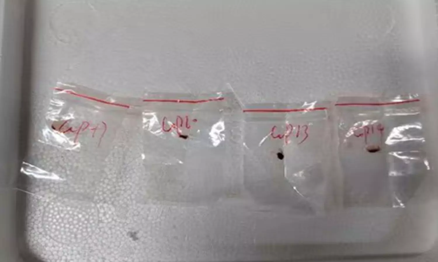 അപകടകാരികളായ ഫംഗസുകൾ കടത്തിയതിന് ചൈനീസ് ഗവേഷകർ അമേരിക്കയിൽ അസ്റ്റിലായ സംഭവം; ചൈനയെ കരുതിയില്ലെങ്കിൽ കോവിഡിനെക്കാൾ ഗുരുതര സ്ഥിതി വിശേഷം ഉണ്ടാകുമെന്ന് വിദഗ്ധരുടെ മുന്നറിയിപ്പ്