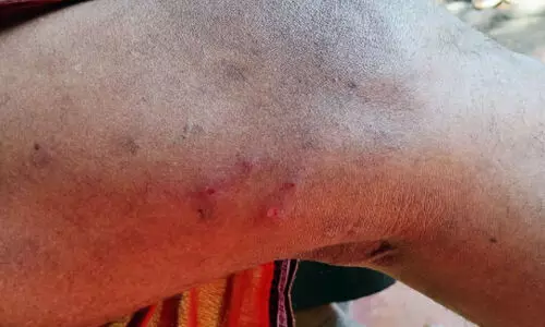 പാ​മ്പ്ര എ​സ്റ്റേ​റ്റി​ൽ പാ​ർ​ത്തീ​നി​യം ചെ​ടി; തൊ​ഴി​ലാ​ളി​ക​ൾ​ക്ക് രോ​ഗം വ്യാ​പി​ക്കു​ന്നു