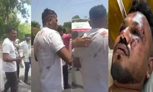 വലിയ സ്ഫോടന ശബ്ദം, എവിടെയോ തെറിച്ചുവീണു, ചുറ്റും ചിതറിക്കിടക്കുന്ന മൃതദേഹങ്ങൾ; ടേക്ക് ഓഫിന് 30 സെക്കന്റിന് ശേഷമാണ് അപകടമെന്ന് രക്ഷപ്പെട്ട വിശ്വാസ് കുമാർ രമേശ്