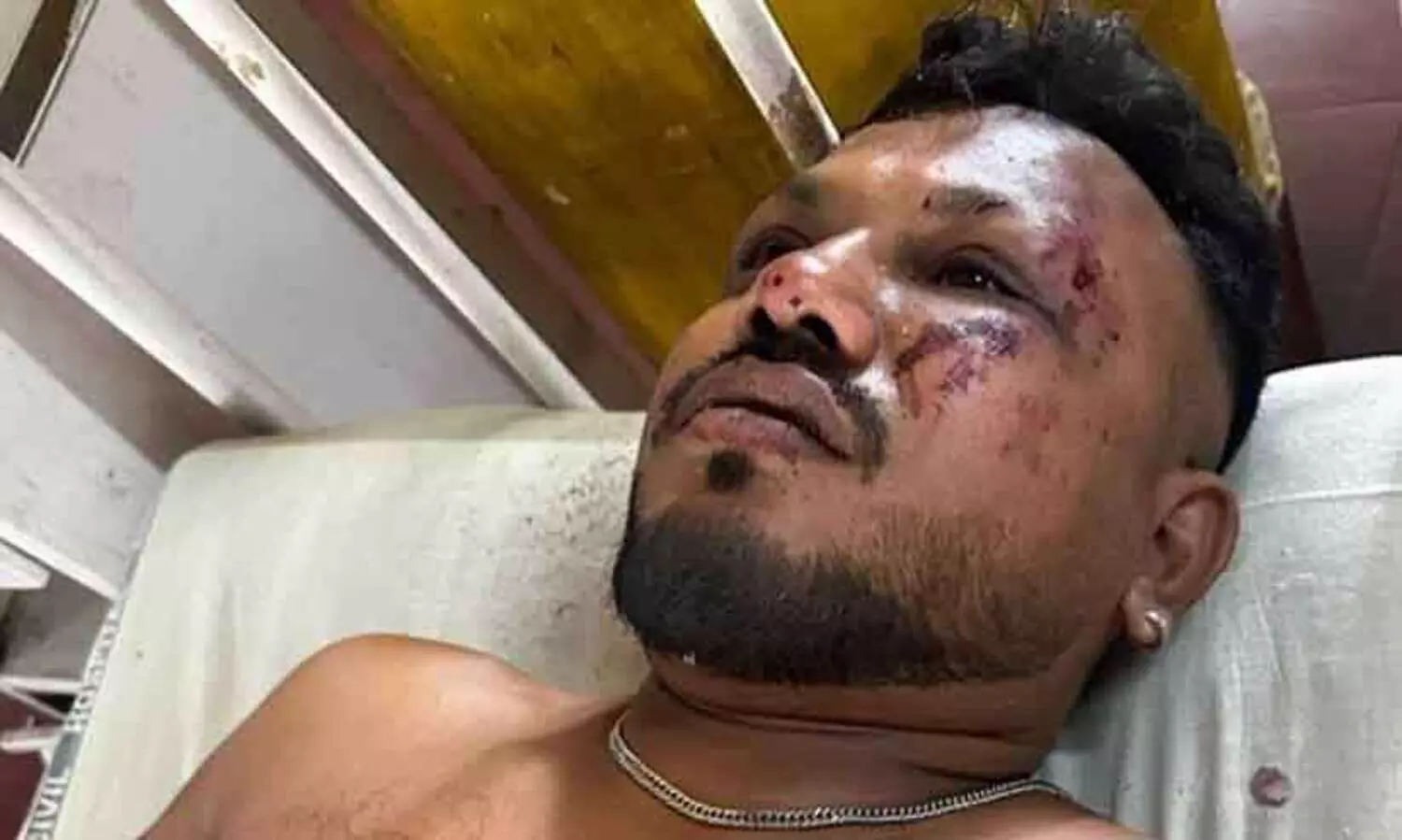 എമർജൻസി എക്സിറ്റിനടുത്ത സീറ്റിലിരുന്നതാണോ കാരണം; അഗ്നിഗോളമായി മാറിയ വിമാനത്തിൽ നിന്ന് ആ അത്ഭുത മനുഷ്യൻ രക്ഷപ്പെട്ടത് എങ്ങനെ?