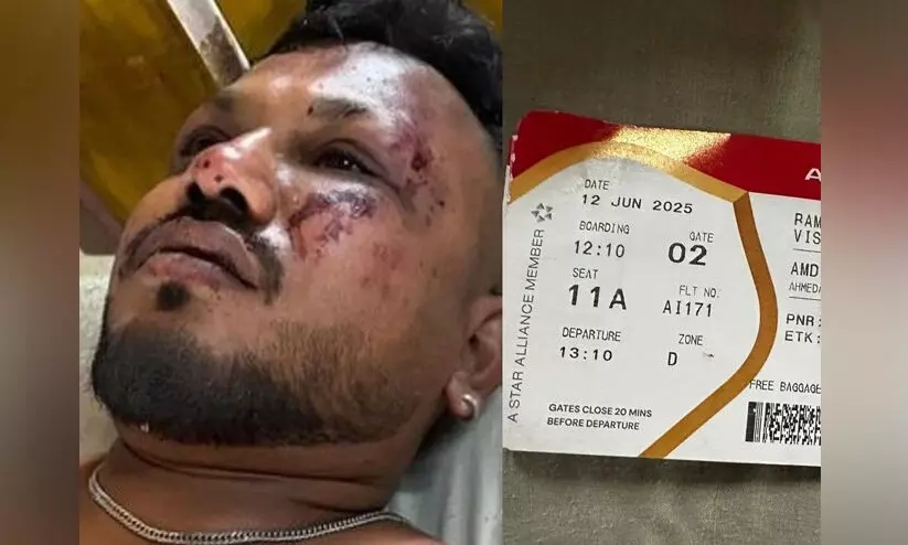 ‘ഇതെന്റെ രണ്ടാം പിറവി: ജീവനോടെയുണ്ടെന്ന് വിശ്വസിക്കാനാവുന്നില്ല’ -വിമാനാപകടത്തിൽ നിന്ന് അദ്ഭുതകരമായി രക്ഷപ്പെട്ട വിശ്വാസ് കുമാർ