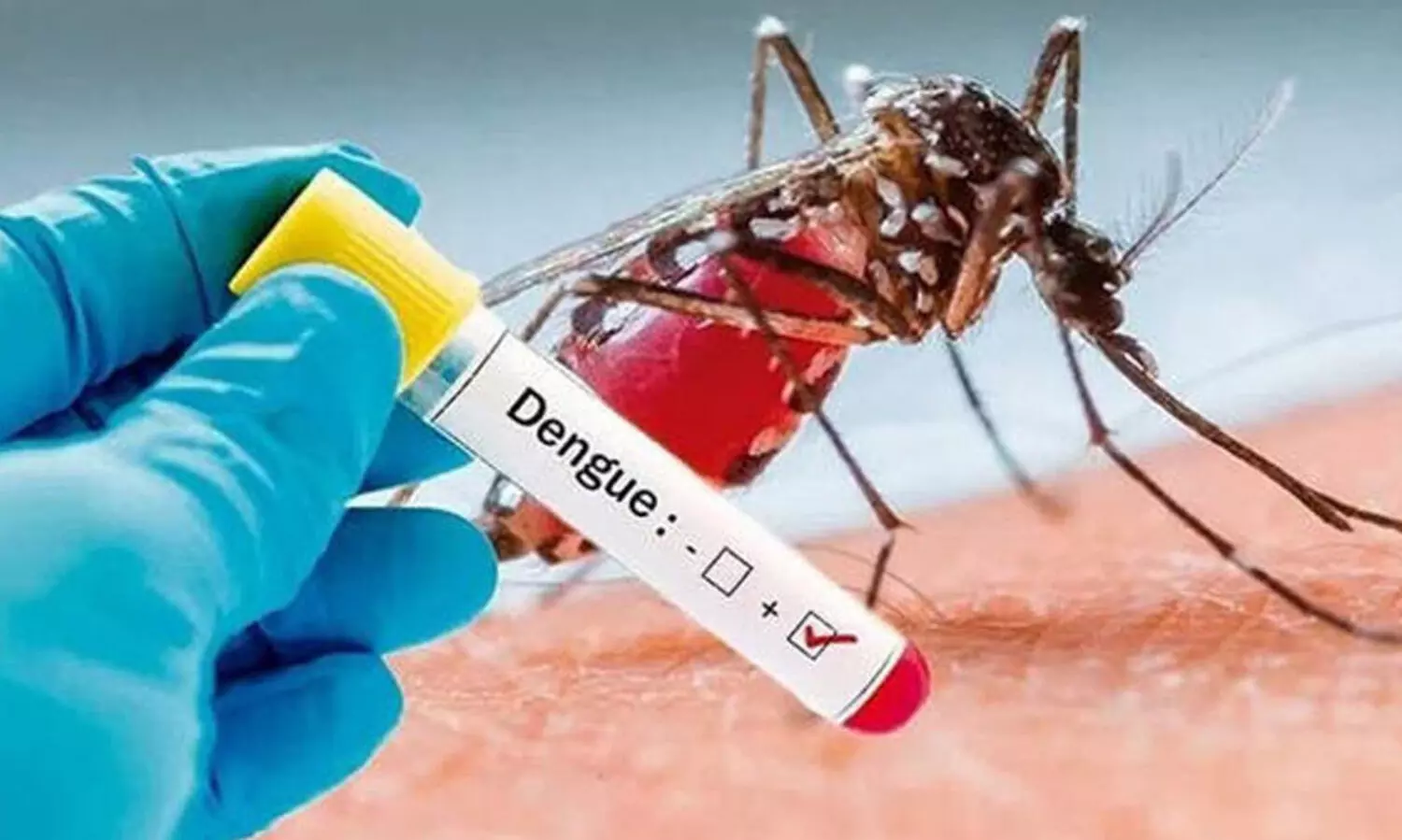 മ​ഴ​ക്കൊ​പ്പം പ​ക​ർ​ച്ച​വ്യാ​ധി​ക​ളും; 13 ദി​വ​സ​ത്തി​നി​ടെ ഡെ​ങ്കി​പ്പ​നി ബാ​ധി​ച്ച​ത് 109 പേ​ർ​ക്ക്