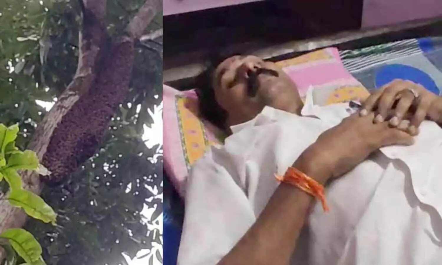 തേനീച്ചക്കൂട് നീക്കം ചെയ്യുന്നതിനിടെ വാർഡ് കൗൺസിലർക്ക് കുത്തേറ്റു