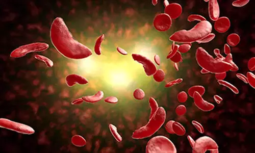 ജി​ല്ല​യി​ൽ 1276 അ​രി​വാ​ൾ രോ​ഗി​ക​ൾ