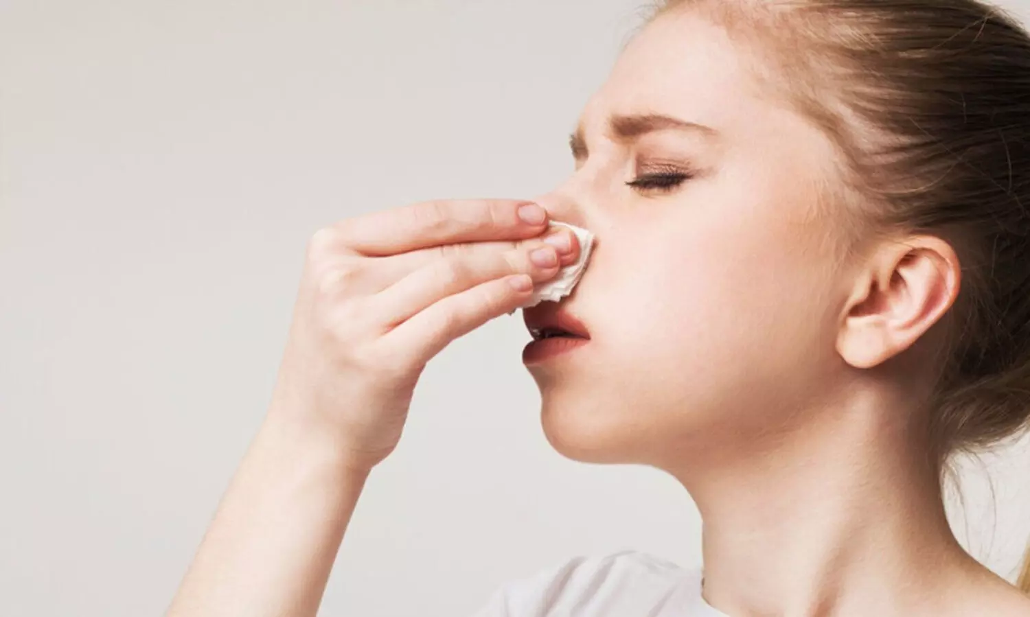 മൂക്കിൽ നിന്ന് രക്തം വരുന്നത അവസ്ഥ (നോസ്ബ്ലീഡ്സ്)