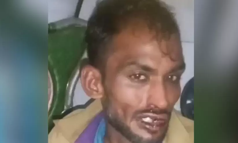 അവർ പേര് ചോദിച്ചു, ജയ്ശ്രീറാം വിളിക്കാൻ പറഞ്ഞു, നിരസിച്ചതോടെ വളഞ്ഞിട്ട് തല്ലി, അടിയിൽ ഒരു ചെവിയുടെ കേൾവി നഷ്ടപ്പെട്ടു; ബംഗളൂരുവിൽ മുസ്‌ലിം ഓട്ടോ ഡ്രൈവർക്ക് ക്രൂരമർദനം