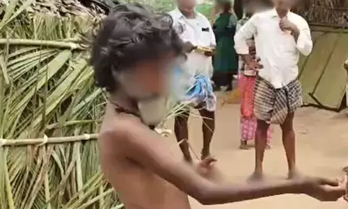 മോഷണക്കുറ്റം ആരോപിച്ച് ആദിവാസി ബാലികയെ മുഖത്തടക്കം ചട്ടുകം വെച്ച് പൊള്ളിച്ചു; ആന്ധ്രയിൽ  5 പേർ അറസ്റ്റിൽ