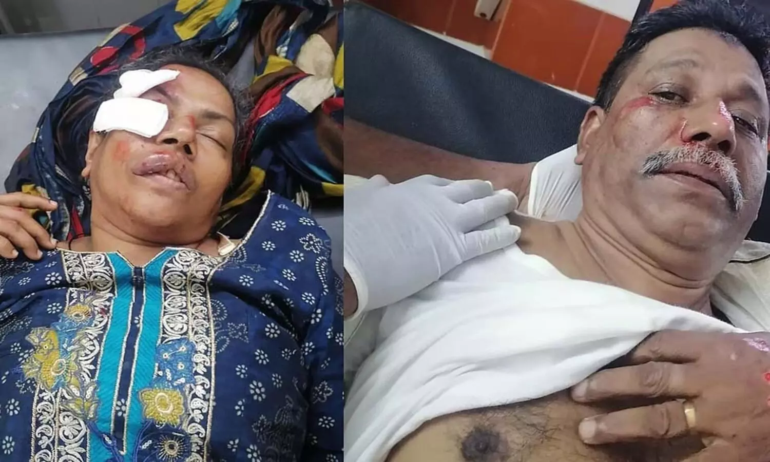 റോഡിലെ കുഴിയിൽ വീണ് ജയിൽ സൂപ്രണ്ടിനും ഭാര്യക്കും ഗുരുതര പരിക്ക്