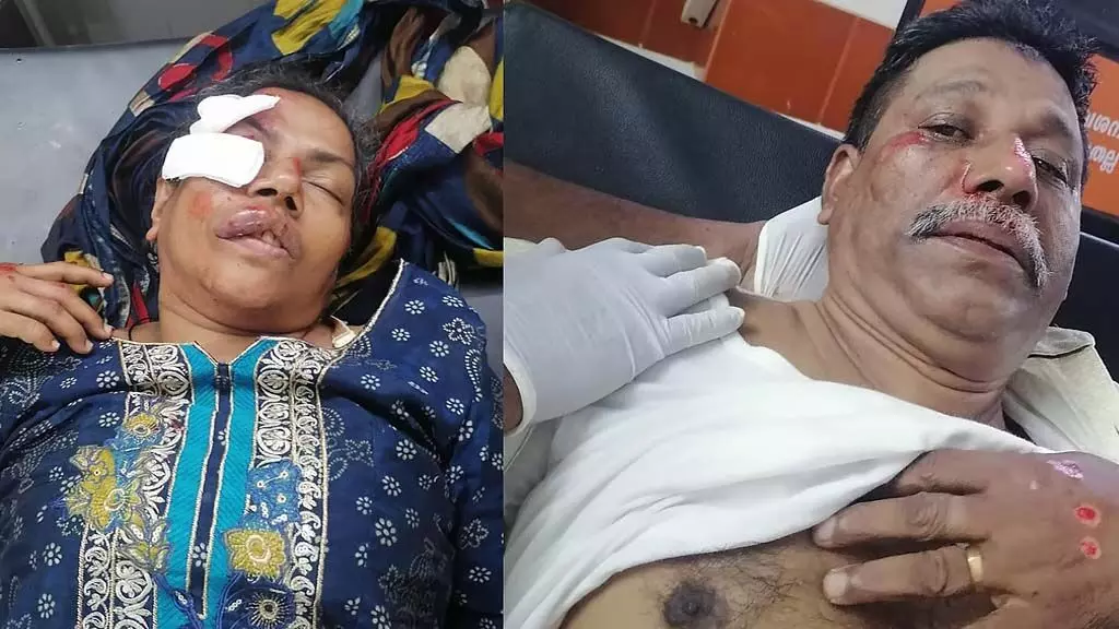 റോഡിലെ കുഴിയിൽ വീണ് ജയിൽ സൂപ്രണ്ടിനും ഭാര്യക്കും ഗുരുതര പരിക്ക്