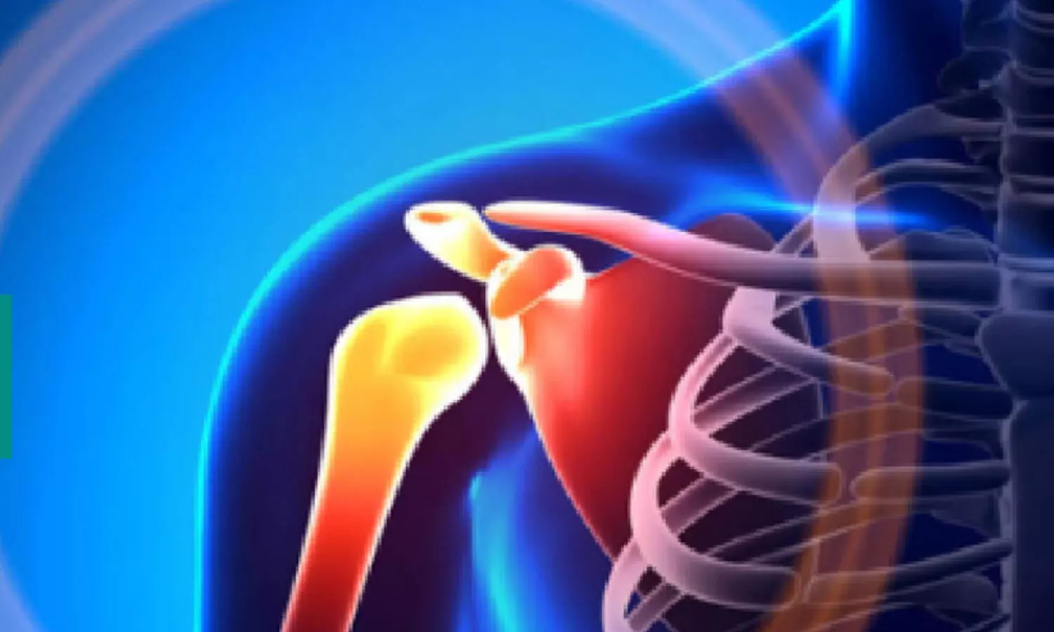 തോ​ൾകു​ഴ ശ​സ്ത്ര​ക്രി​യ​ക്ക് എ.ഐ; കൃത്യത, വേഗത്തിൽ രോഗമുക്തി