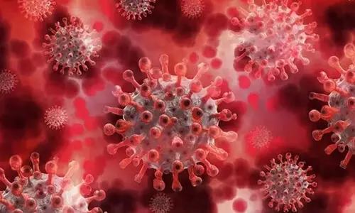 Nipah Virus