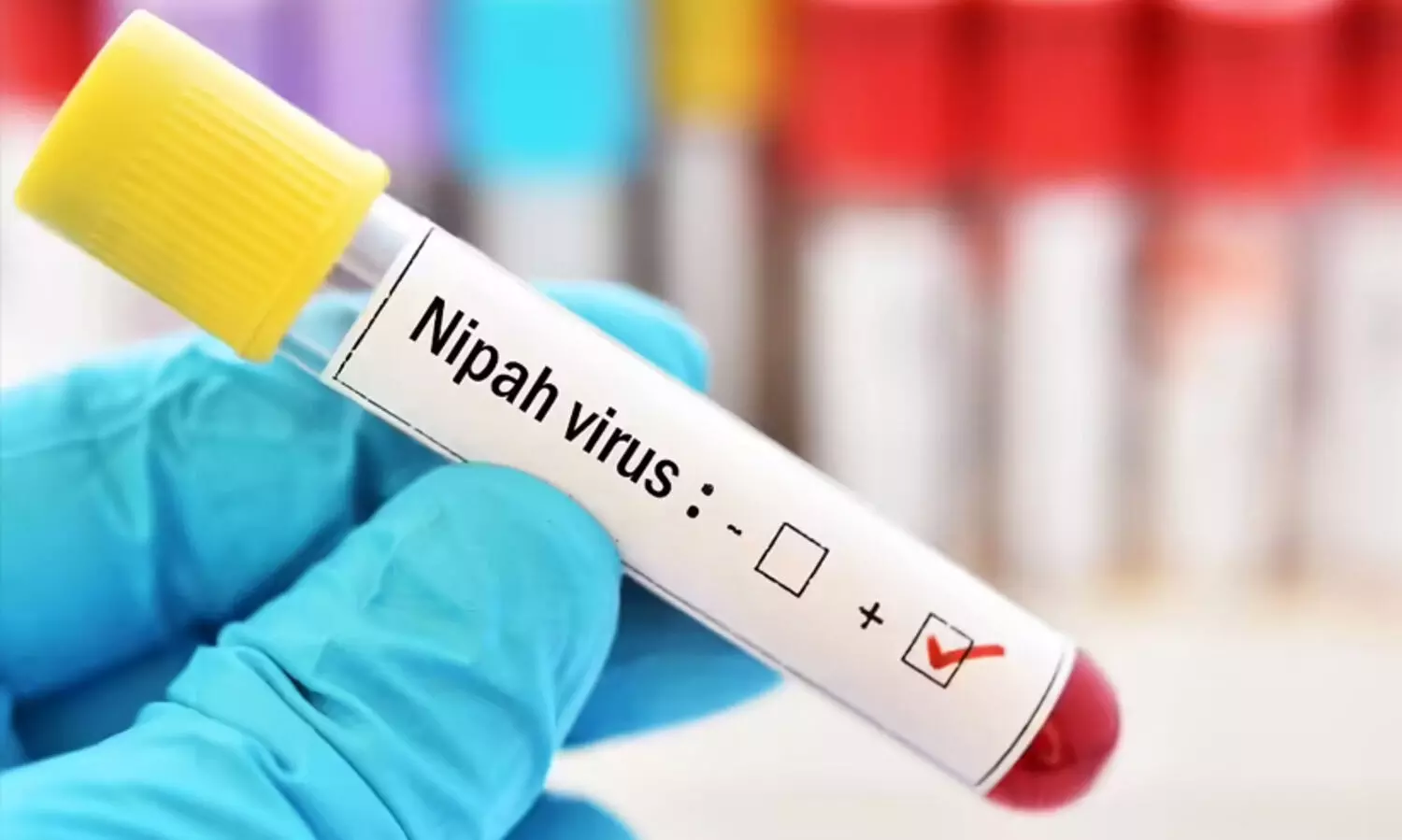 Nipah Virus
