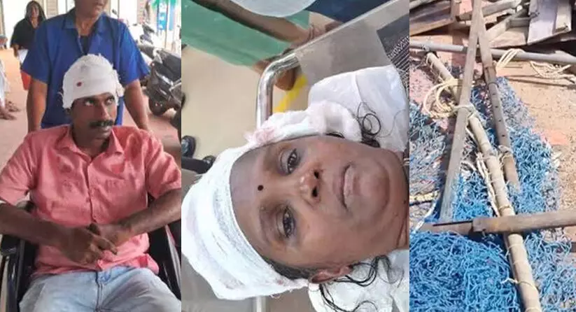 കൊല്ലം റെയിൽവേ സ്റ്റേഷനിൽ യാത്രക്കാരുടെ തലയിലേക്ക് ഇരുമ്പ് കമ്പി വീണു; രണ്ടുപേർക്ക് പരിക്ക് കൊല്ലം റെയിൽവേ സ്റ്റേഷനിൽ യാത്രക്കാരുടെ തലയിലേക്ക് ഇരുമ്പ് കമ്പി വീണു; രണ്ടുപേർക്ക് പരിക്ക്