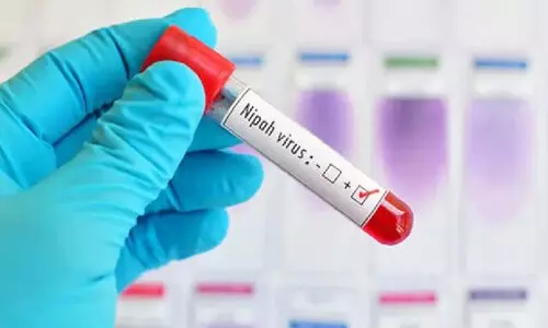 നിപ: പാലക്കാട്ടെ രണ്ടാമത്തെ കേസില് 46 പേർ സമ്പര്ക്ക പട്ടികയിൽ നിപ: പാലക്കാട്ടെ രണ്ടാമത്തെ കേസില് 46 പേർ സമ്പര്ക്ക പട്ടികയിൽ