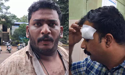 താക്കോൽക്കൂട്ടം ഉപയോഗിച്ച് അസി. മോട്ടോർ ഇൻസ്പെക്ടറെ ആക്രമിച്ചു, നെറ്റിയിൽ നാല് തുന്നൽ; പ്രതി​യെ ജീവനക്കാർ കീഴ്പ്പെടുത്തി പൊലീസിന് കൈമാറി