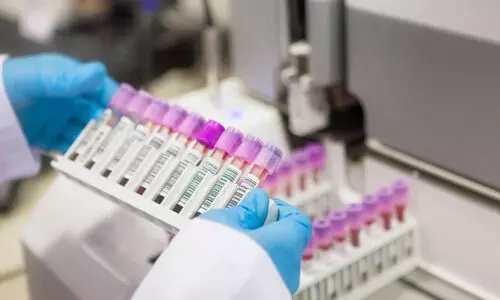 സിക്കിൾ സെൽ അനീമിയ, ഹെപ്പറ്റെറ്റിസ് ബി, ടി.ബി, തലാസീമിയ  പരിശോധനകൾ ഇനി പ്രാഥമികാരോഗ്യമേഖലയിലും വരുന്നു; മോളിക്കുലാർ പരിശോധനകളും ഇനി വേഗം