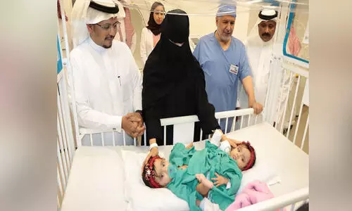 സ​യാ​മീ​സ്​ വേ​ർ​പ്പെ​ടു​ത്ത​ൽ; യാ​ര​യു​ടെ​യും ലാ​റ​യു​ടെ​യും ആ​രോ​ഗ്യ​നി​ല തൃ​പ്​​തി​ക​രം -ഡോ. ​അ​ൽ​റ​ബീ​അ