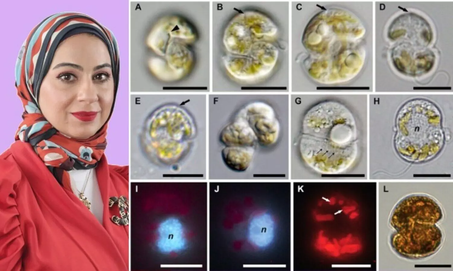 കുവൈത്തിൽ മത്സ്യങ്ങളുടെ ‘കൂട്ടകൊലക്ക്’ കാരണമാകുന്ന സൂക്ഷ്മ ആൽഗകളെ കണ്ടെത്തി