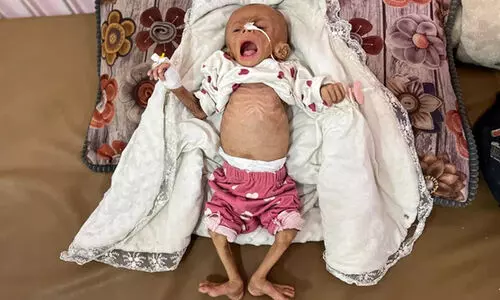 ഗസ്സയിലെ ക്രൂരതക്കെതിരെ ഒടുവിൽ ഇസ്രായേൽ മെഡിക്കൽ അസോസിയേഷനും രംഗത്ത്: ‘ഇത് മെഡിക്കൽ എത്തിക്‌സിന്റെയും അന്താരാഷ്ട്ര നിയമങ്ങളുടെയും ഗുരുതരമായ ലംഘനം’