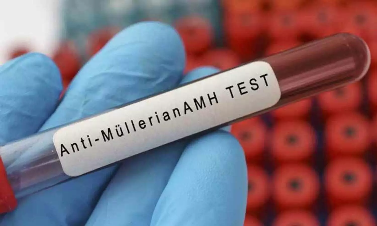 30 വയസിന് മുമ്പ് ആർത്തവ വിരാമം സംഭവിക്കുന്ന സ്ത്രീകളുടെ എണ്ണം വർധിക്കുന്നു; കാരണം?