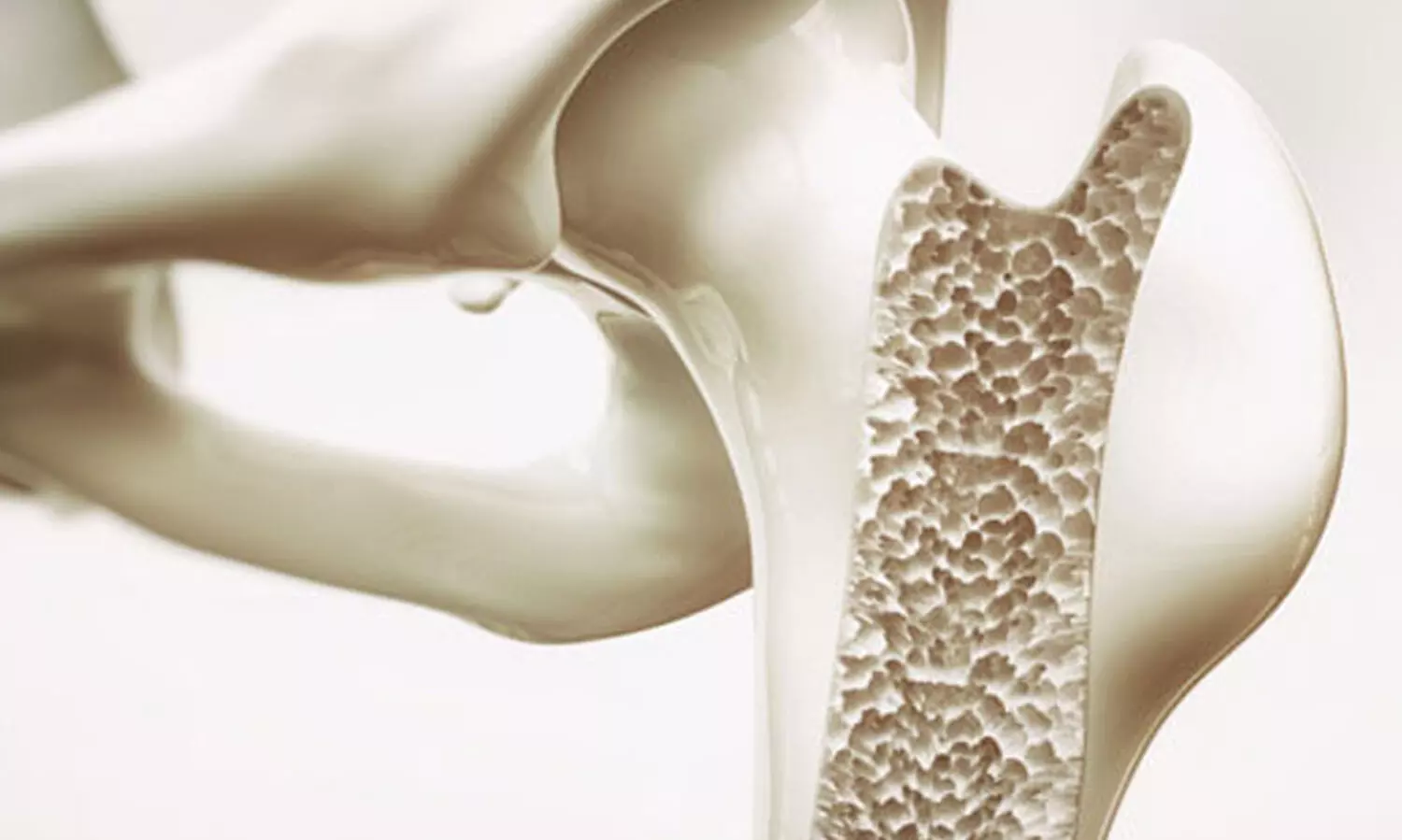 അ​സ്ഥി​രോ​ഗ​ങ്ങ​ൾ; ശ്ര​ദ്ധി​ക്കേ​ണ്ട കാ​ര്യ​ങ്ങ​ളി​ൽ ചി​ല​ത്