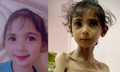 ‘അത് നമ്മുടെ കുഞ്ഞല്ല എന്നതുകൊണ്ട് കൊല്ലുന്ന ഇസ്രയേലിനെ പിന്തുണയ്ക്കുന്നവർ രൂപത്തിൽ മാത്രമേ മനുഷ്യനായിട്ടുള്ളു...’ ‘അത് നമ്മുടെ കുഞ്ഞല്ല എന്നതുകൊണ്ട് കൊല്ലുന്ന ഇസ്രയേലിനെ പിന്തുണയ്ക്കുന്നവർ രൂപത്തിൽ മാത്രമേ മനുഷ്യനായിട്ടുള്ളു...’