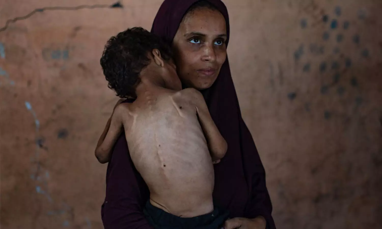 ഗസ്സക്ക് ഉടനടി തടസ്സമില്ലാത്ത മാനുഷിക സഹായം വേണം; അതികഠിനമായ പട്ടിണിയെക്കുറിച്ച്  മുന്നറിയിപ്പുമായി യു.എന്നിന്റെ ഭക്ഷ്യസുരക്ഷാ സംഘടന