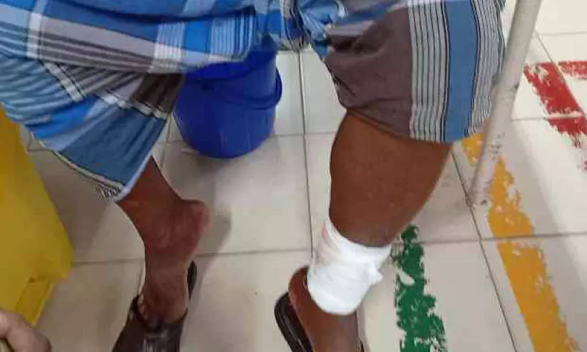 നിലമേലിൽ തെരുവുനായ ശല്യം;10 പേർക്ക് കടിയേറ്റു നിലമേലിൽ തെരുവുനായ ശല്യം;10 പേർക്ക് കടിയേറ്റു