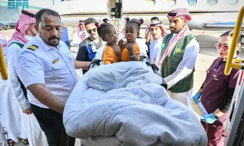 വേ​ർ​പെടു​ത്ത​ൽ ശ​സ്​​ത്ര​ക്രി​യ; ജമൈക്കൻ സയാമീസ്​ ഇരട്ടകളെ റിയാദിലെത്തിച്ചു