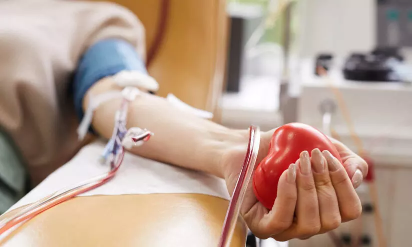 representative image representative image