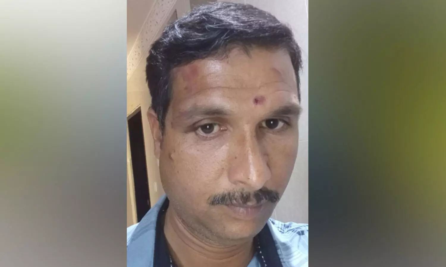 ബത്​ഹയിൽ കത്തി കാട്ടി അതിക്രമവും പിടിച്ചുപറിയും; മലയാളി ഡ്രൈവർക്ക്​ പരിക്കേറ്റു