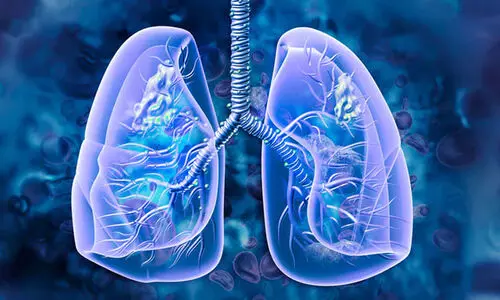 ശ്വാ​സ​കോ​ശ അ​ർ​ബു​ദ കേ​സു​ക​ളി​ൽ 40 ശ​ത​മാ​നം വ​ർ​ധ​ന