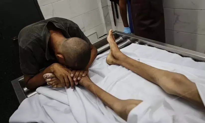 ഗസ്സയുടെ ചാമ്പ്യനായിരുന്നു ആതിഫ്... പട്ടിണിയിൽ അവ​ന്റെ ശരീരം 70 കിലോയിൽ നിന്നും 25ലേക്ക് മെലിഞ്ഞുണങ്ങി.. ഒടുവിൽ അവനും വിശന്നു മരിച്ചു...