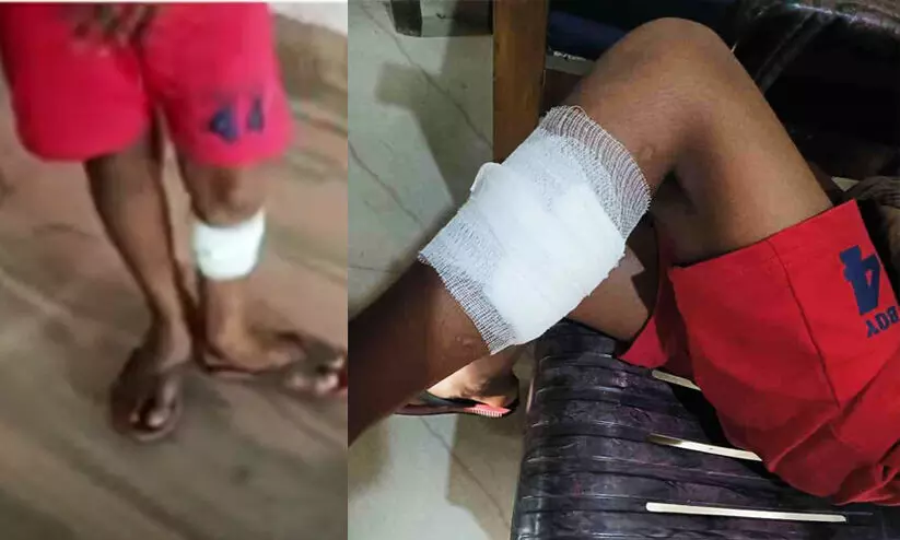 Eight-year-old boy brutally abused by stepfather