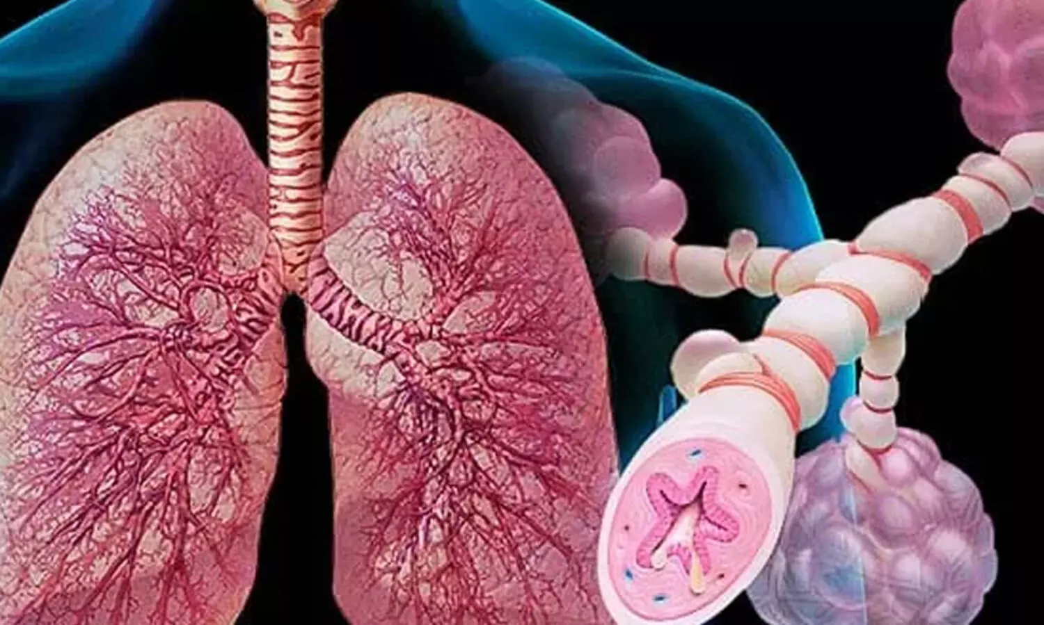 ആ​സ്ത​മ​യെ നി​സ്സാ​ര​മാ​യി കാ​ണ​രു​ത്