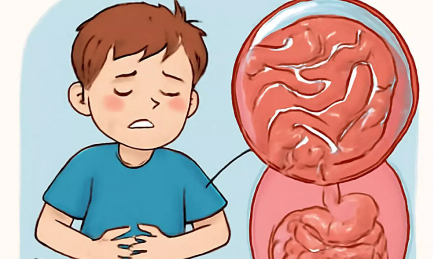 വി​ര​ശ​ല്യം നി​സ്സാ​ര​മാ​ക്കേ​ണ്ട