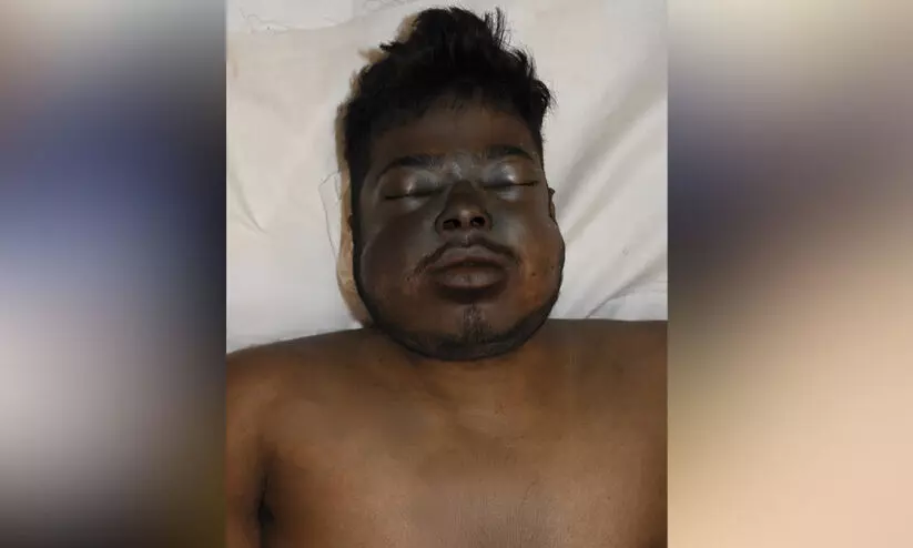 മൃതദേഹം തിരിച്ചറിയാൻ സഹായം തേടി പൊലീസ് മൃതദേഹം തിരിച്ചറിയാൻ സഹായം തേടി പൊലീസ്