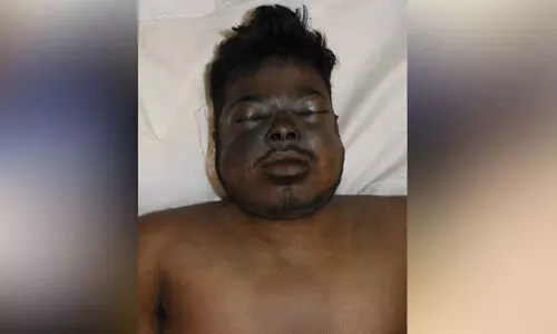 മൃതദേഹം തിരിച്ചറിയാൻ സഹായം തേടി പൊലീസ്​