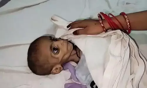 ‘പെൺകുട്ടിയല്ലേ, അവൾ മരിക്കട്ടെ...’ -അച്ഛന്റെ കുടുംബം ചികിത്സ നിഷേധിച്ച 15 മാസം പ്രായമുള്ള കുഞ്ഞ് പട്ടിണികിടന്ന് മരിച്ചു; തൂക്കം വെറും 3.7 കി.ഗ്രാം