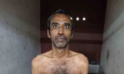 Son arrested for stabbing father with a kitchen knife