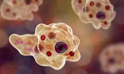 amoebic encephalitis