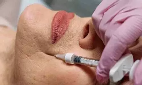 പേരക്കുട്ടിയുടെ ട്യൂഷൻ ഫീസുൾപ്പെടെ 8600 ഡോളർ ചെലവഴിച്ച് മുഖത്തെ ചുളിവുകൾ മാറ്റാൻ ഈ ചൈനീസ് മുത്തശ്ശി പ്ലാസ്റ്റിക് സർജറി ചെയ്തു; പിന്നീട് സംഭവിച്ചത്... പേരക്കുട്ടിയുടെ ട്യൂഷൻ ഫീസുൾപ്പെടെ 8600 ഡോളർ ചെലവഴിച്ച് മുഖത്തെ ചുളിവുകൾ മാറ്റാൻ ഈ ചൈനീസ് മുത്തശ്ശി പ്ലാസ്റ്റിക് സർജറി ചെയ്തു; പിന്നീട് സംഭവിച്ചത്...