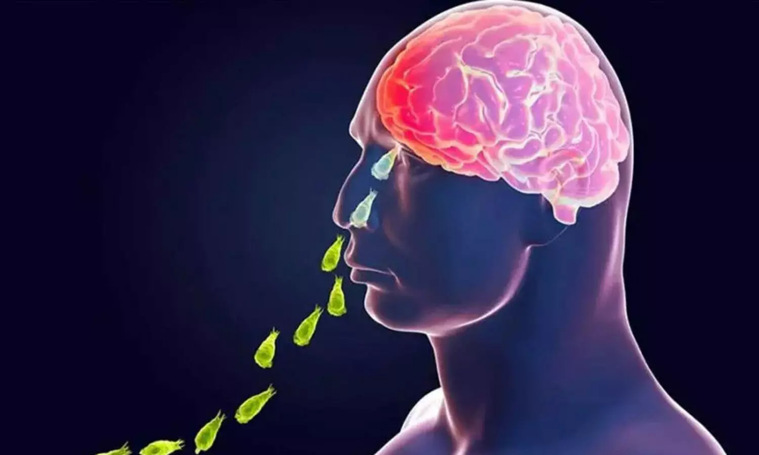 അമീബിക് മസ്തിഷ്ക ജ്വരം; മുക്കം നഗരസഭയിൽ പ്രതിരോധ നടപടി ഉടൻ