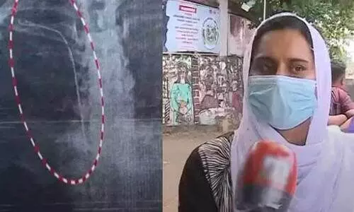 തിരുവനന്തപുരം ജനറല്‍ ആശുപത്രിയില്‍ ശസ്ത്രക്രിയയില്‍ ഗുരുതര വീഴ്ചയെന്ന് പരാതി;  ട്യൂബ് ഉള്ളിൽ കുടുങ്ങിയെന്ന് യുവതിയുടെ കുടുംബം