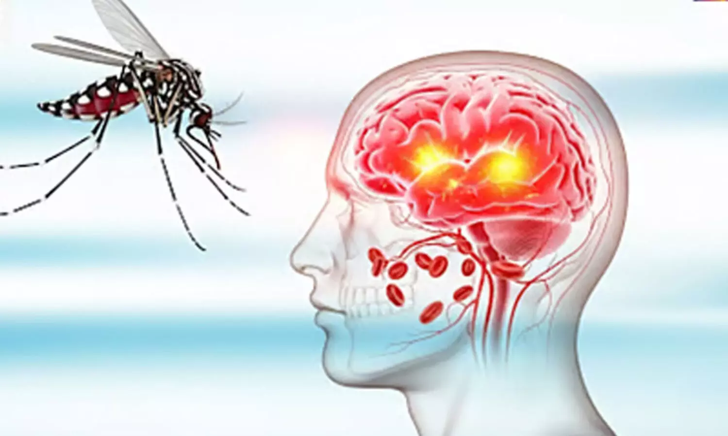 ഡെങ്കു വൈറസ് തലച്ചോറിനെയും നാഡീവ്യൂഹത്തെയും ബാധിക്കാം; മുംബൈയിൽ നാൽപത്തിയാറുകാരൻ ചികിൽസയിൽ