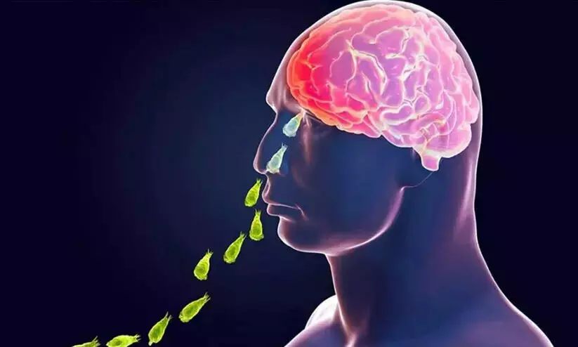 amoebic encephalitis